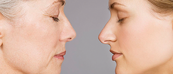 Why does skin ageing occur?