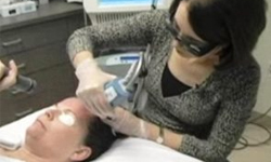 How does Carbon-di-oxide laser treatment work?