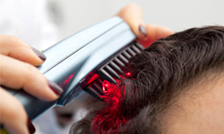 How does laser therapy for hair loss work?