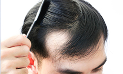 hair_transplant_work_effectively