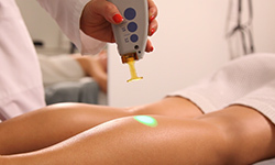 How many sessions does an average laser hair removal process require?