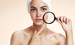 Acne is caused by dirty skin