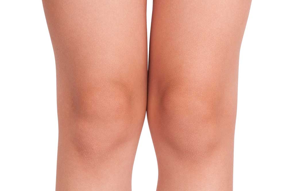 Causes of dark elbows and knees