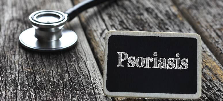 Dr. Sachin Varma Answers FAQ's on Psoriasis