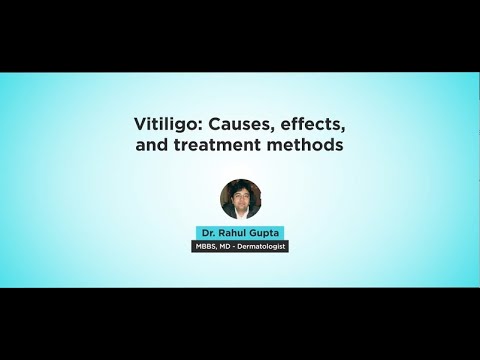 Learn more about Vitiligo from an expert- Dr. Rahul Gupta