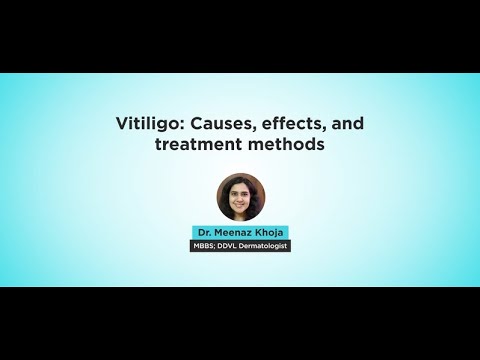 Diagnosing Vitiligo the right way