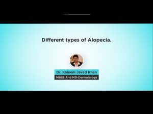 Types of Alopecia | Video by Dr. Kaleem Khan