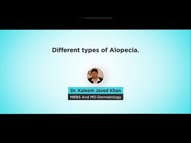 Types of Alopecia