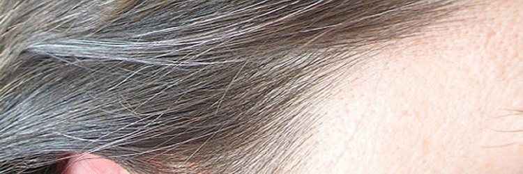 Discovered a white hair streak in your tresses? Learn about premature greying