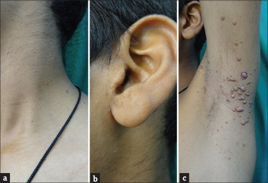 Skin examination of the patient