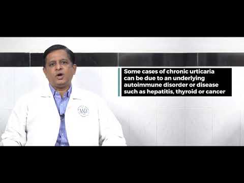 Urticaria Video by Dr Kiran Godse