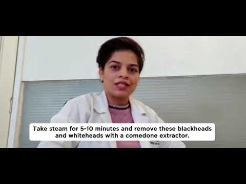 Available remedies and treatments for blackheads and whiteheads