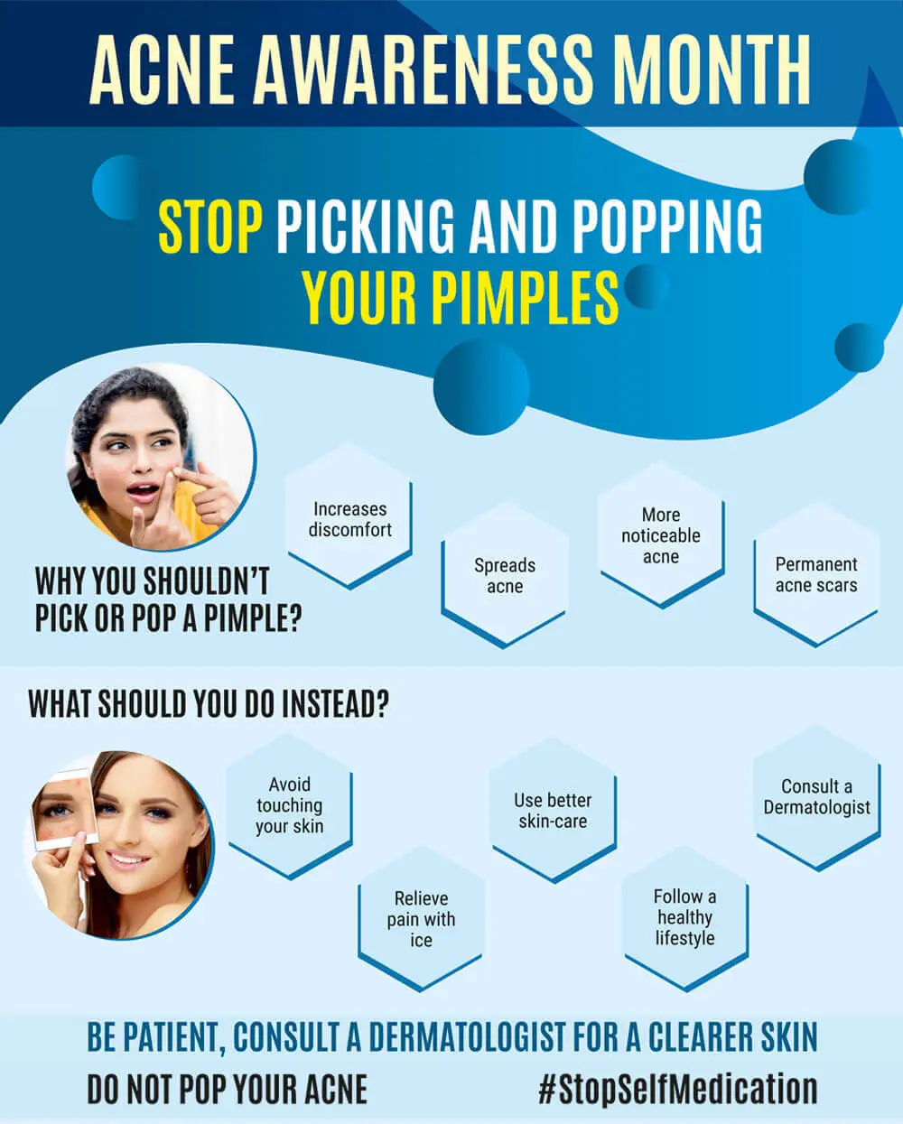 HOW TO TREAT PIMPLES?