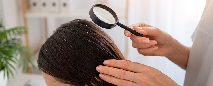 Say Goodbye to Flakes_ A Guide to Dandruff-Free Hair